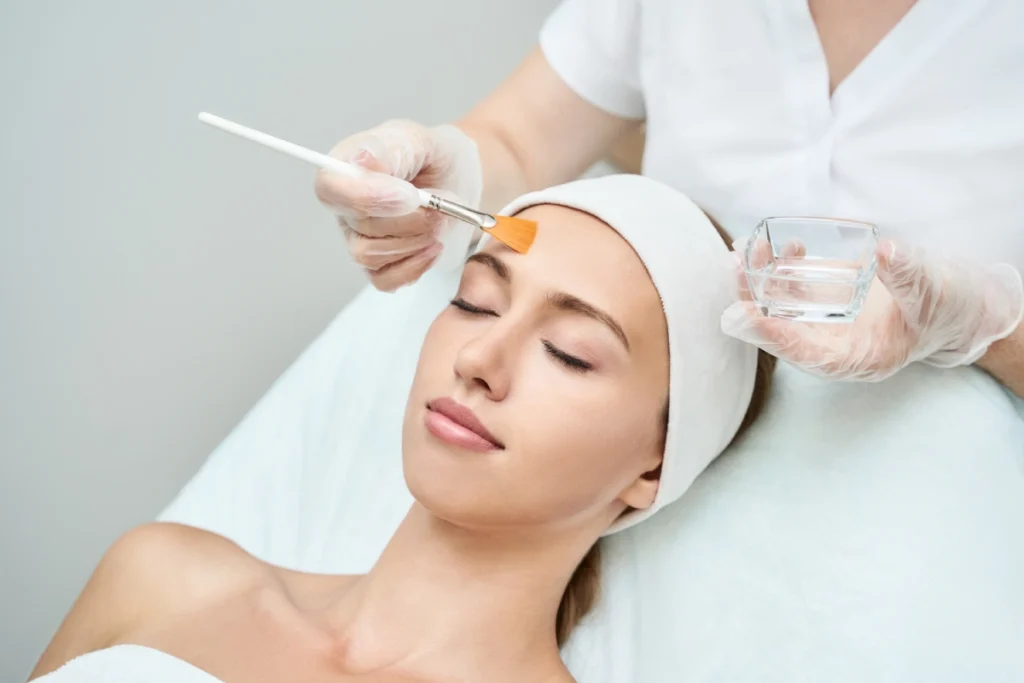 Chemical-Peel-Treatments-services