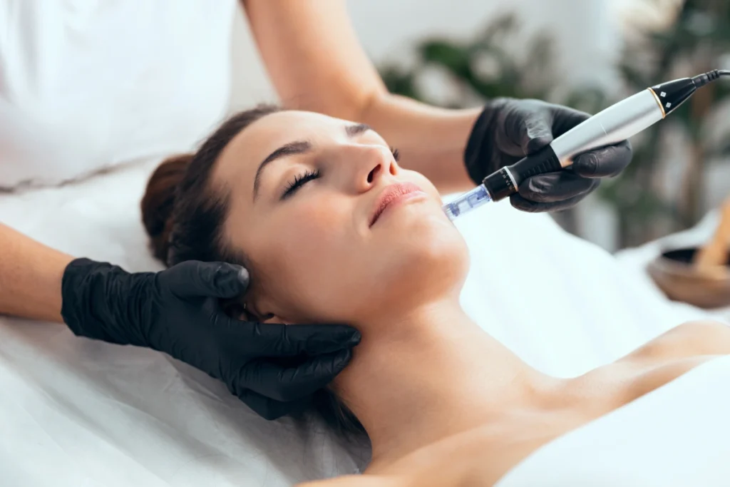 Microneedling-Treatments