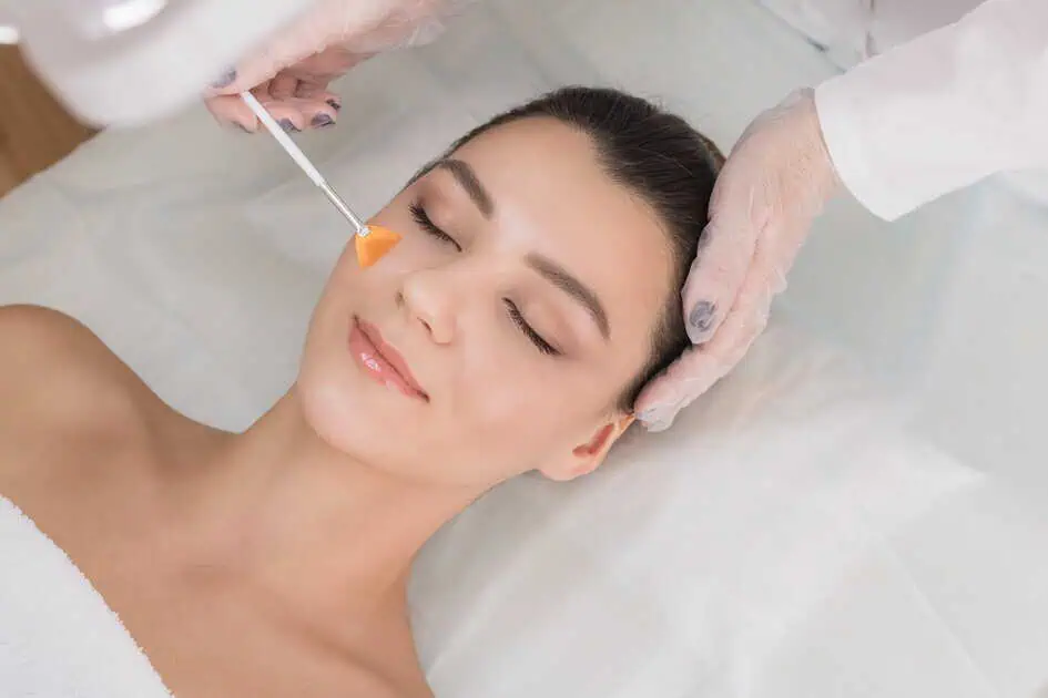 chemical peels Treatment in Missouri by HC Diversified two LLC