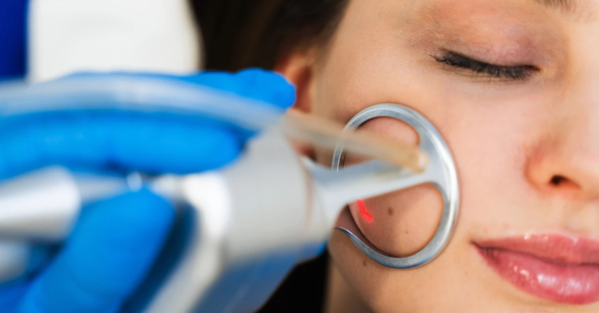 CO₂ Laser aftercare in Lee’s Summit, MO